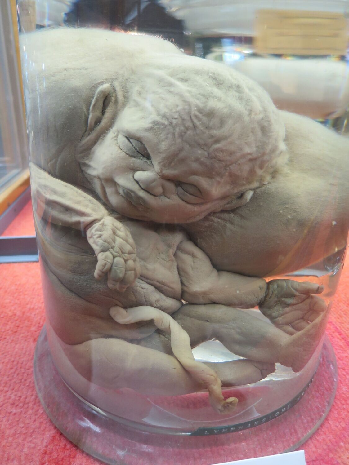 Staring at Death – The Medical Atrocities (collector's edition)