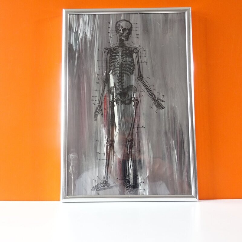 "Billy Bones"