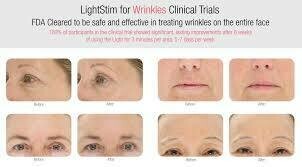 LightStim For Wrinkles