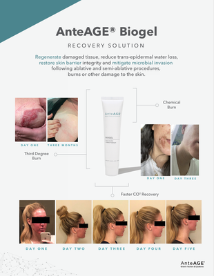 AnteAGE Biogel