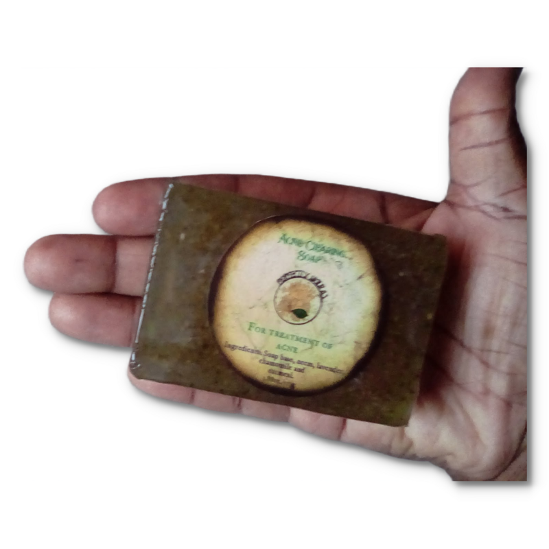 Acne Clearing Soap bar