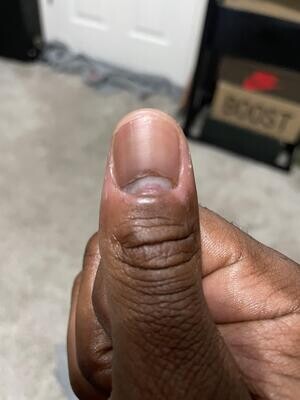 Damaged Nail and  Scar Removal Products
