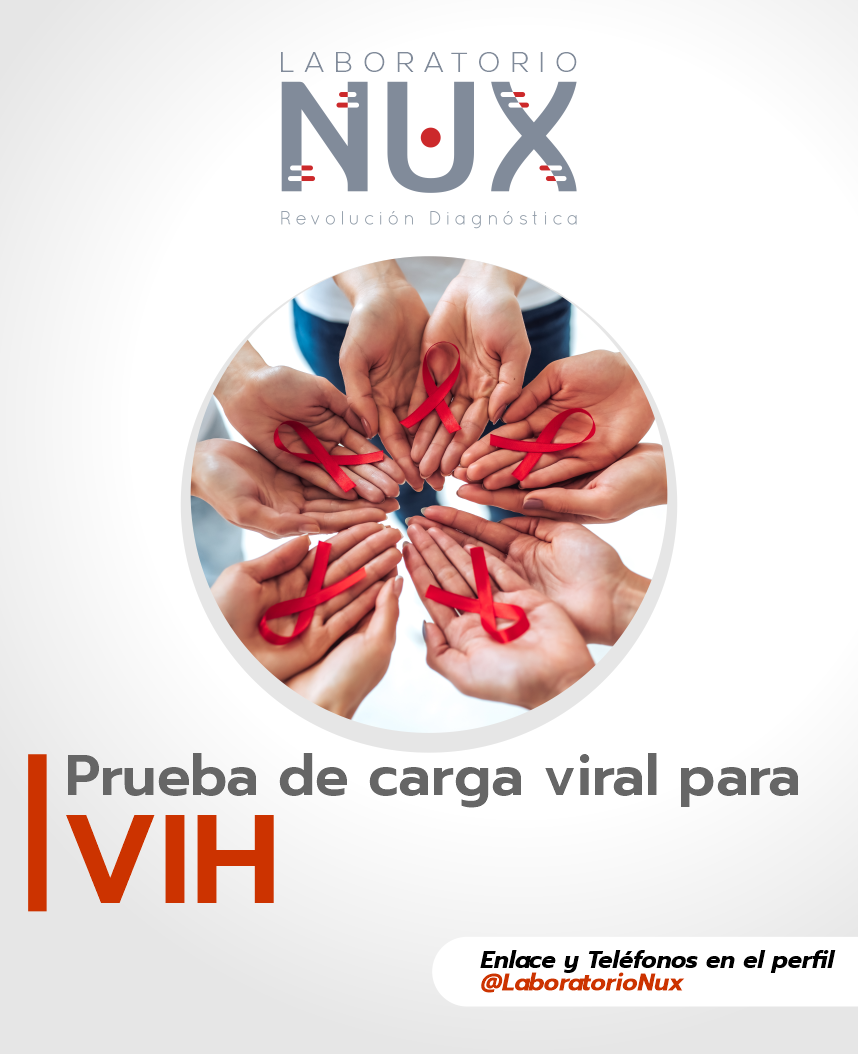 VIH-1 carga viral