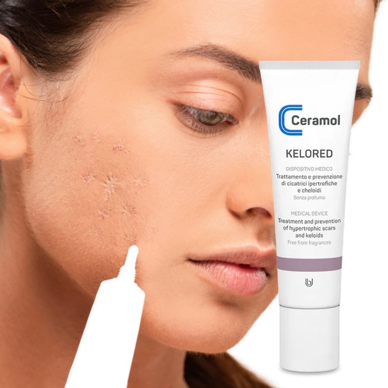 Ceramol Kelored Narben-Gel 30ml