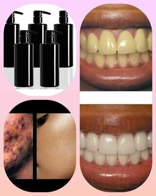 Tooth Stain Remover