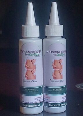 STRETCH MARK REMOVER