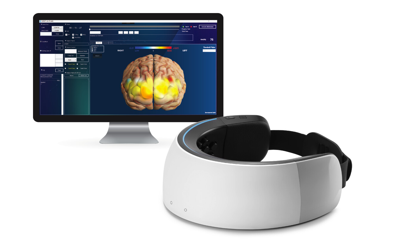 Monitor y Scaner Cerebral