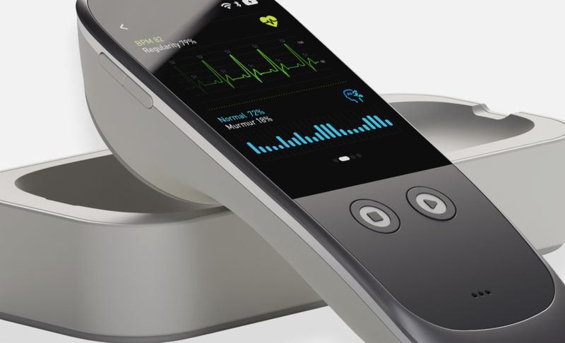 Estetoscopio con inteligencia artificial