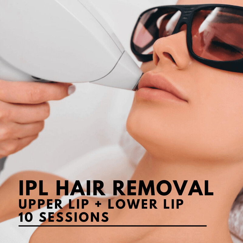 IPL Hair Removal Upper and Lower Lip (10 Sessions)
