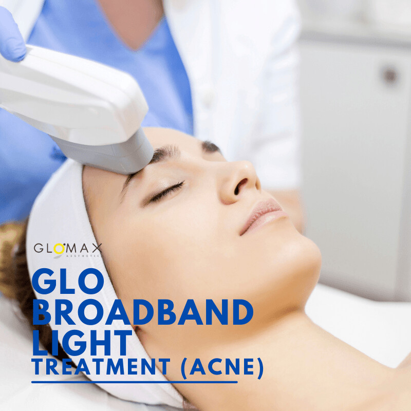GLO Broadband Light Acne Treatment (First Trial)