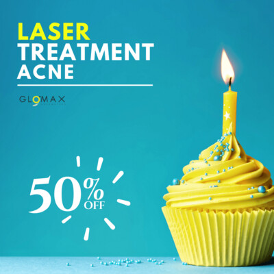 Laser Acne Treatment (Birthday Treats)