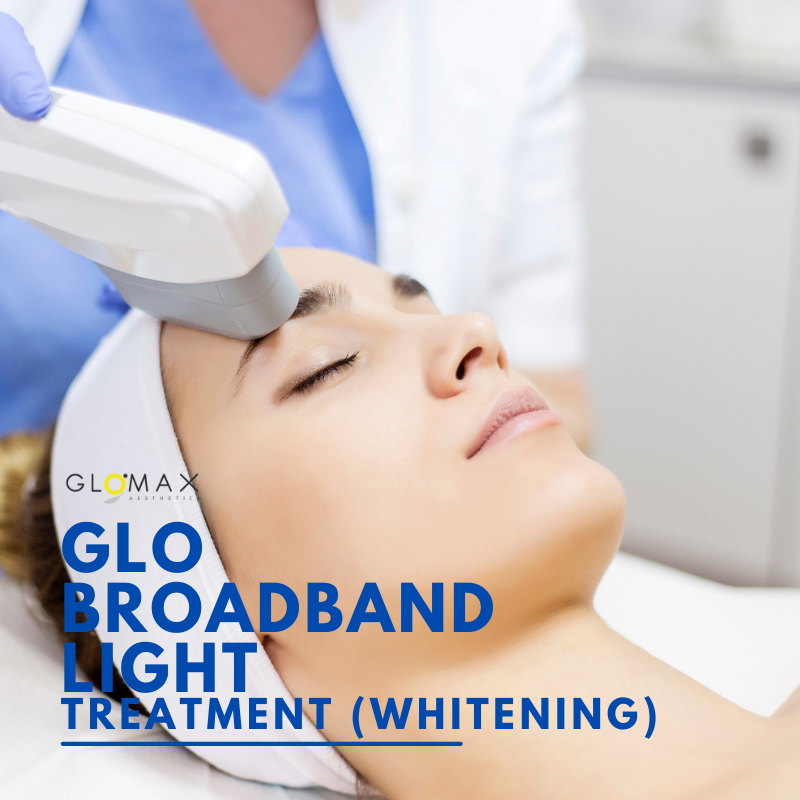 GLO Broadband Light NT800 Whitening Treatment (First Trial)