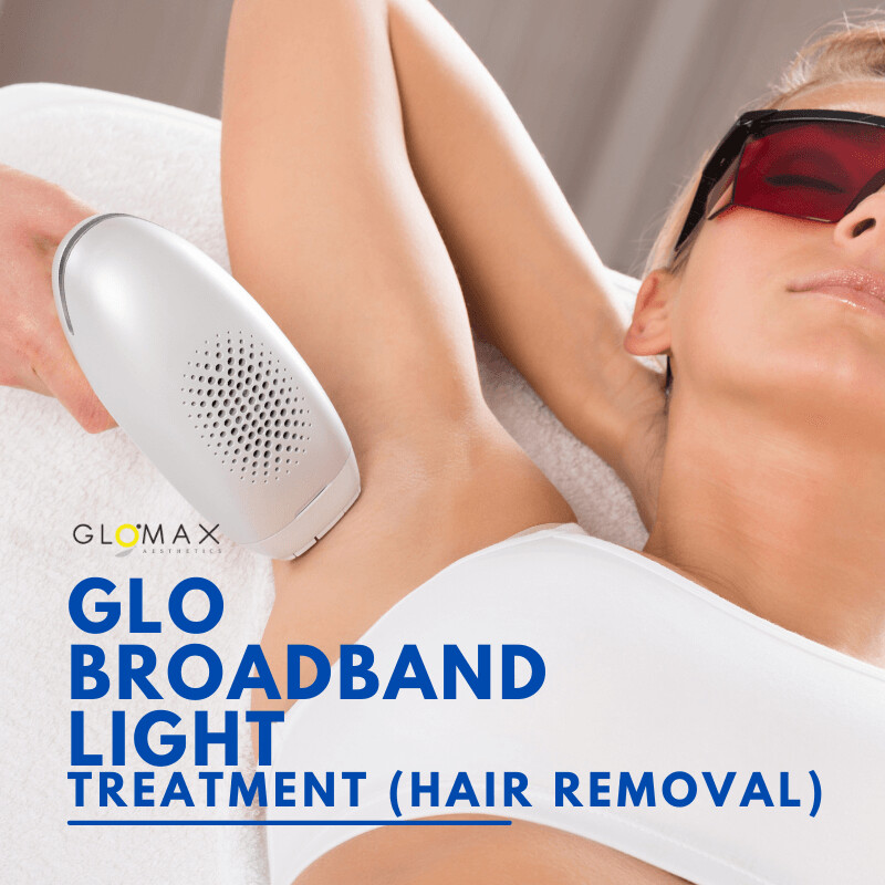 GLO Broadband Light Treatment - Hair Removal Underarm (First Trial)