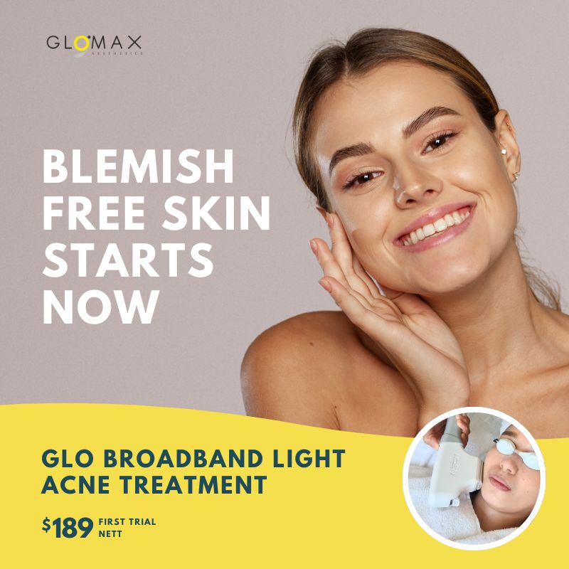 GLO Broadband Light Acne Treatment (First Trial)
