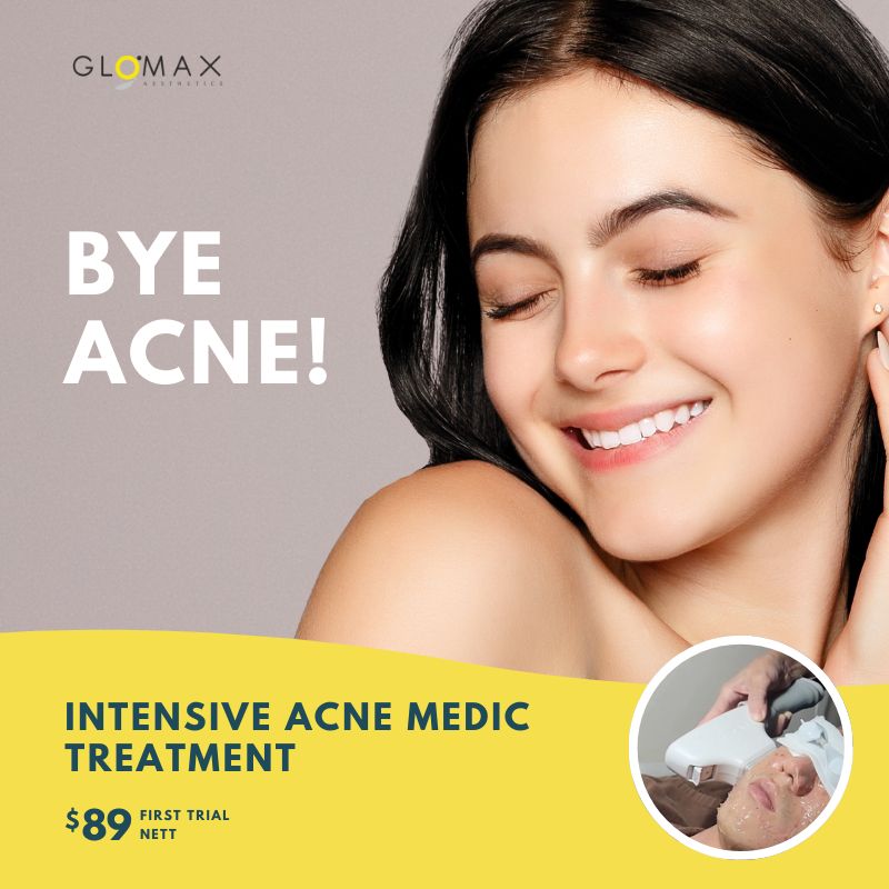Intensive Acne Medic Treatment (First Trial)