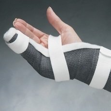 Splinting - North Coast Medical