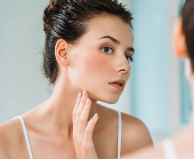 Sensitive &amp; Inflammatory Skin Conditions
