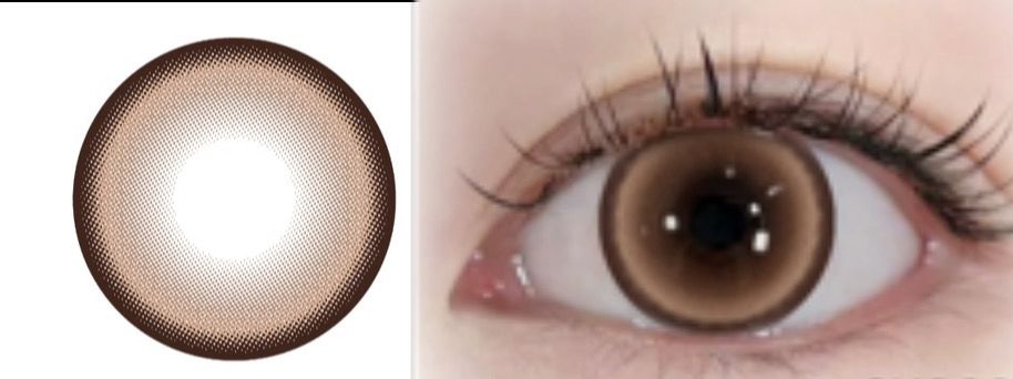 All Lenses
