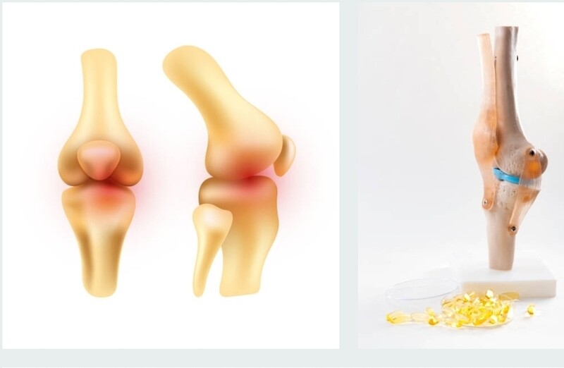 Bone and joints care