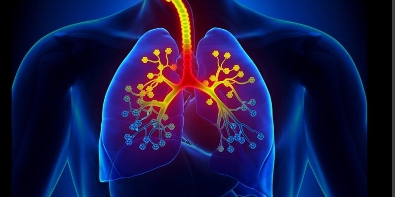 Asthma