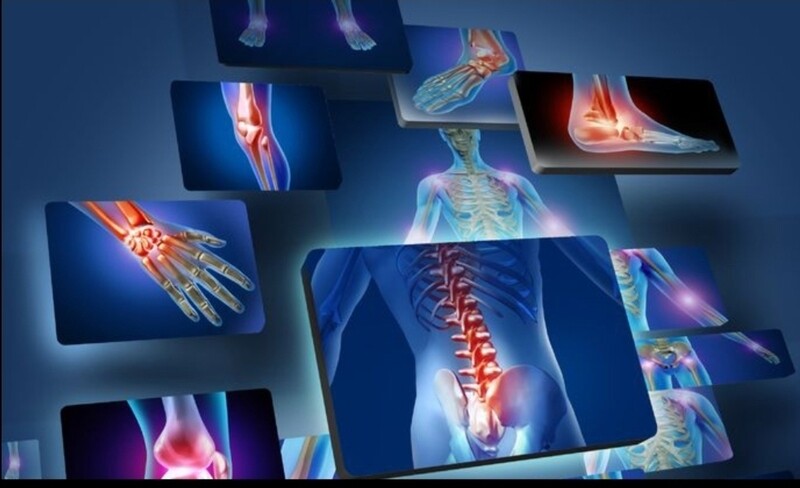 Bone &amp; joint problem