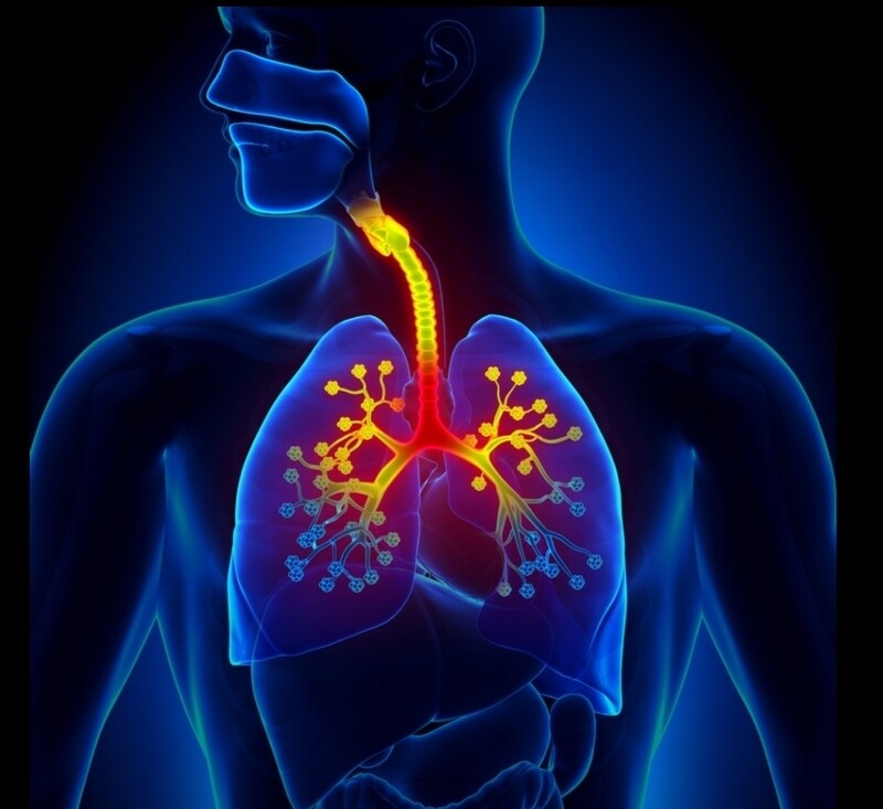 Bronchitis