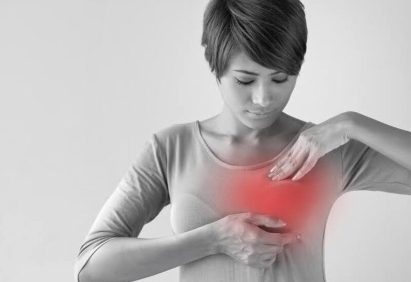 Breast Disorders