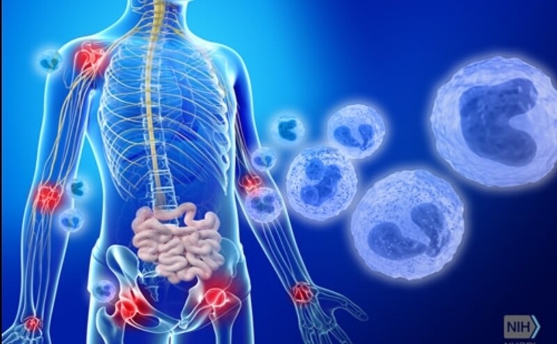 Inflammatory  Disease