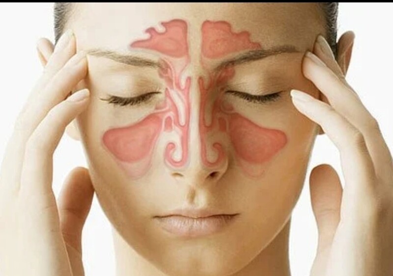 Sinuses