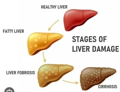 Livergen problem treatment