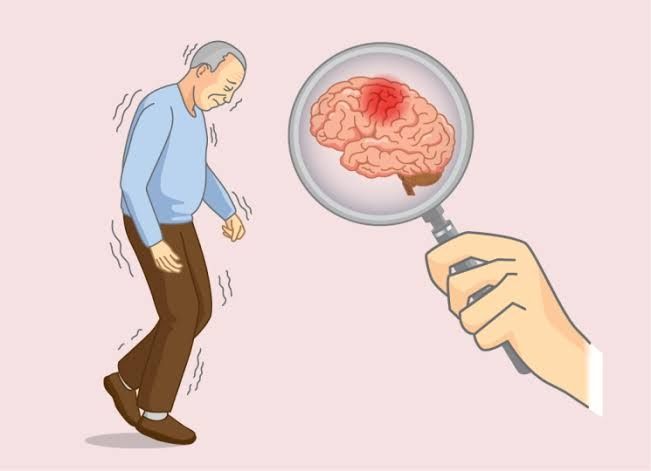 Brain care