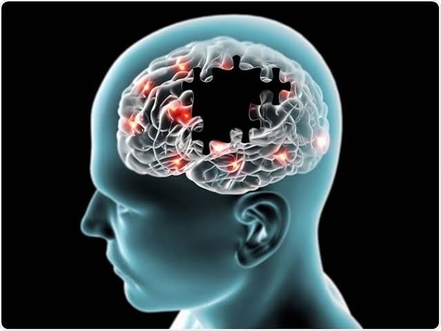 Alzhemers