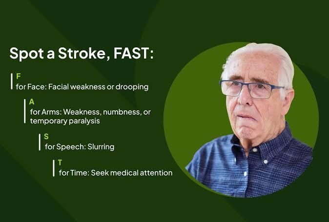Stroke