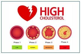 Cholesterol