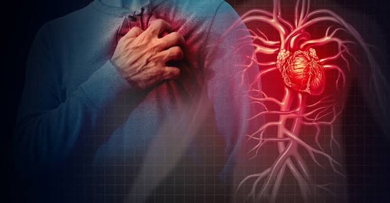 Cardiovascular disease
