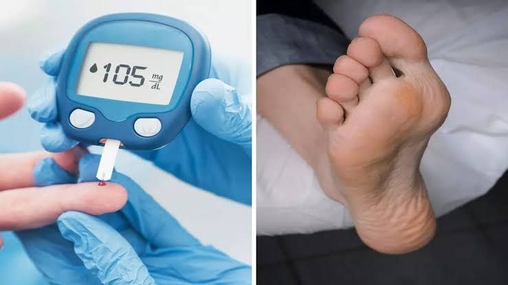 Prevention of diabetes