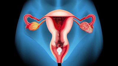 Uterus Cleansing pearls