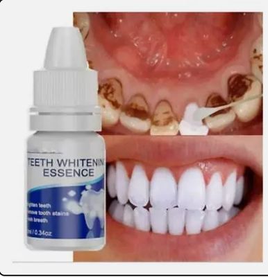 Teeth Whitening Essences Extra Strong White Hygiene Tooth Whitener Stain Removal(10 ml)