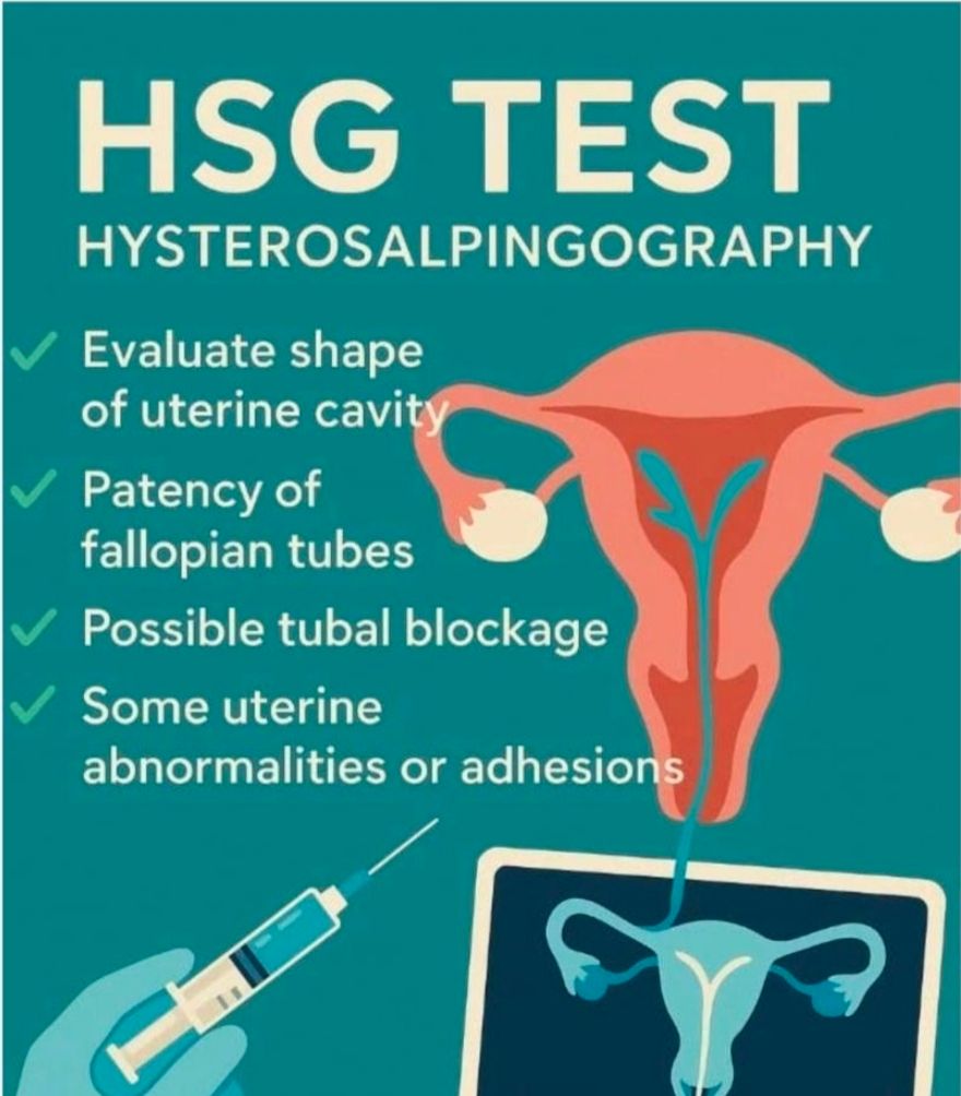 Hsg xray (checking tubes blockage) in Nairobi