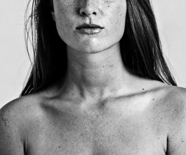 PIGMENTATION