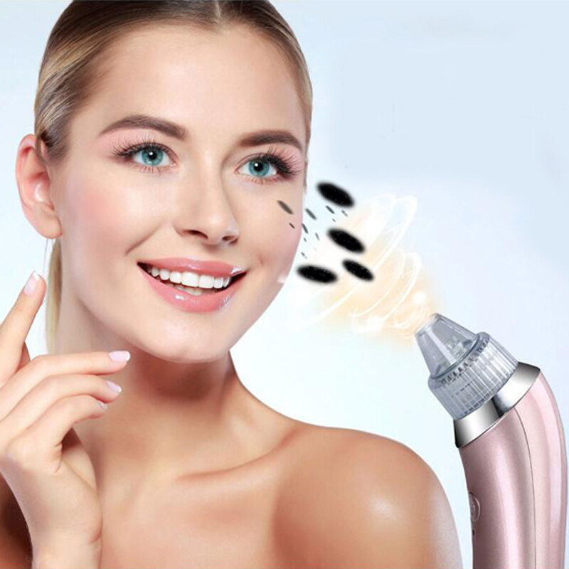 Blackhead Remover