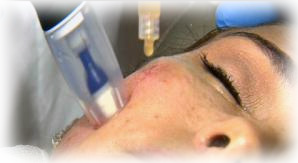 Plasma Facial