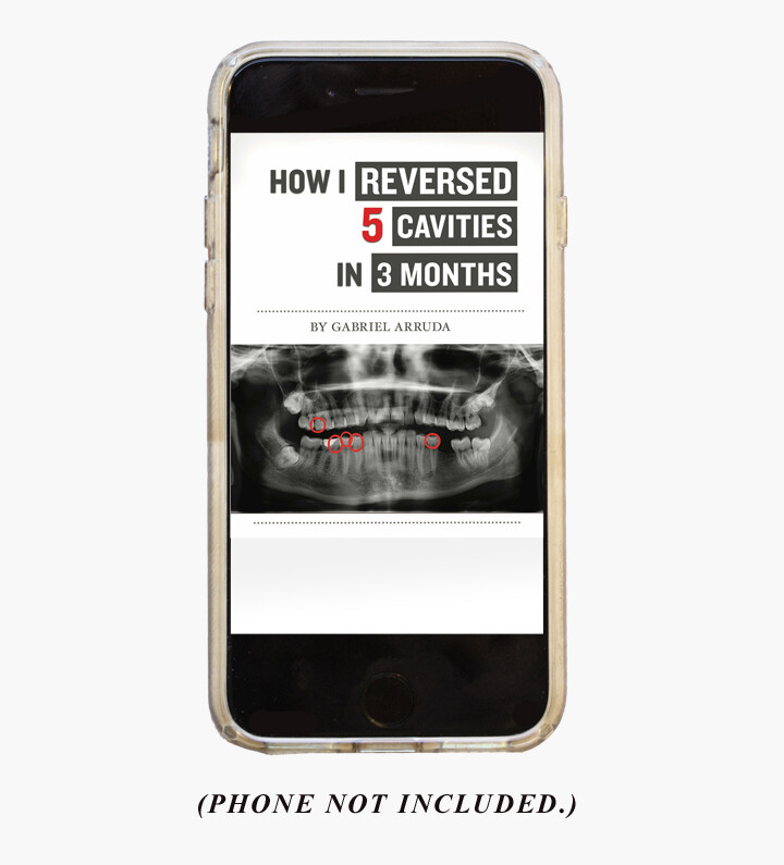 How I Reversed 5 Cavities in 3 Months eBook