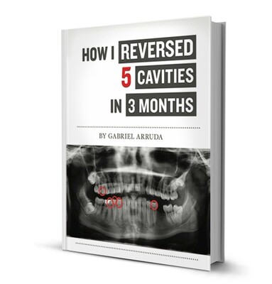 How I Reversed 5 Cavities in 3 Months