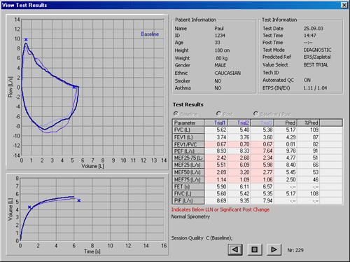 ndd EasyWare Software ndd EasyWare Software