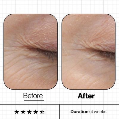 AGING SKIN