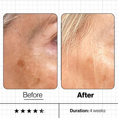 UNEVEN SKIN TONE