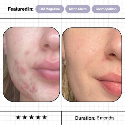 Skin Accumax™ 14-Week Reset Kit