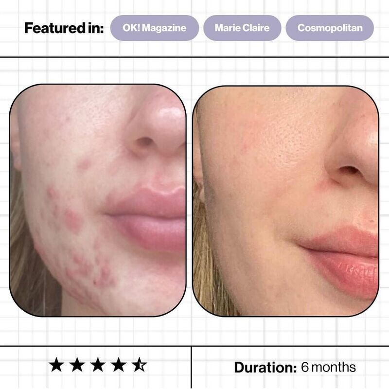 Skin Accumax™