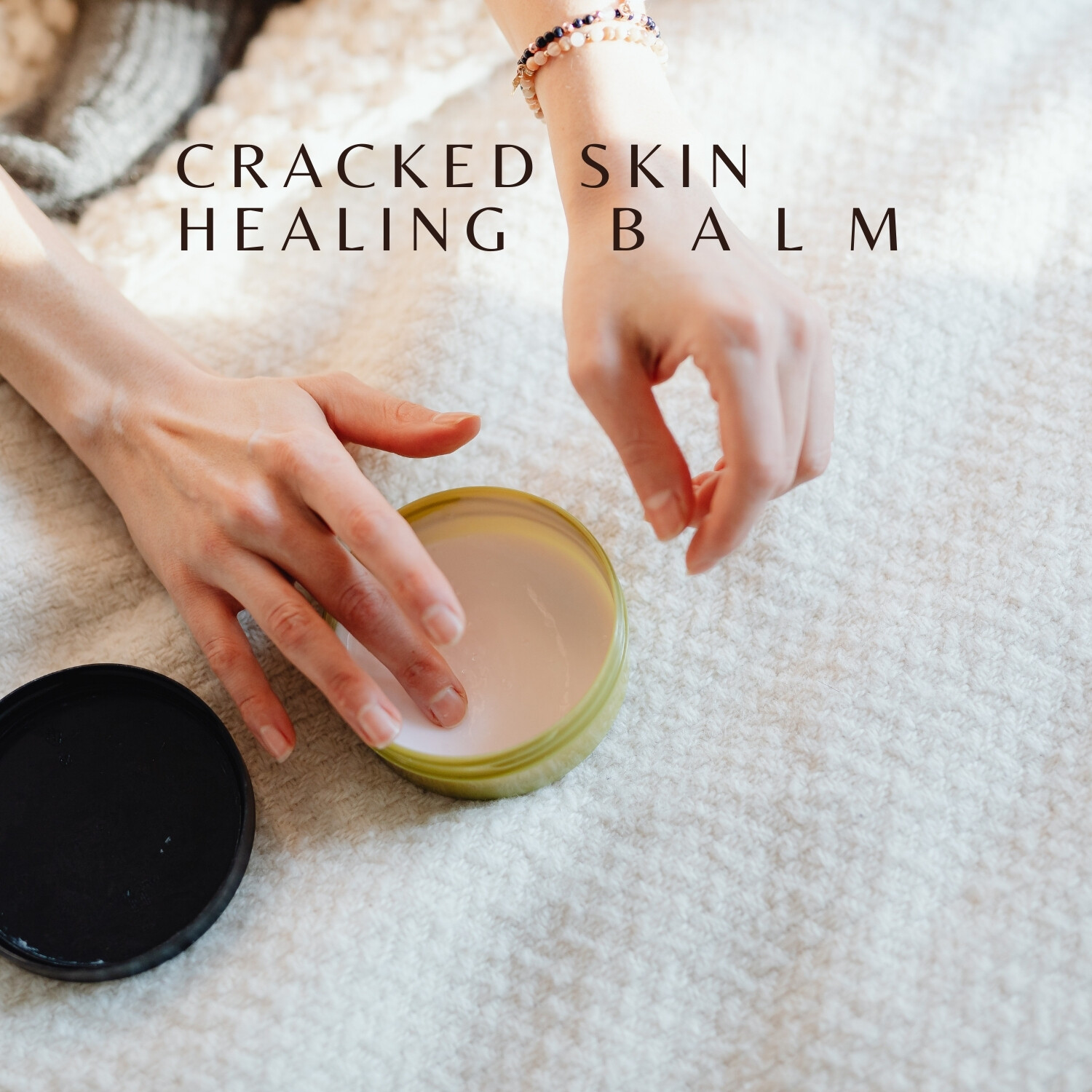 Cracked Skin Healing Balm